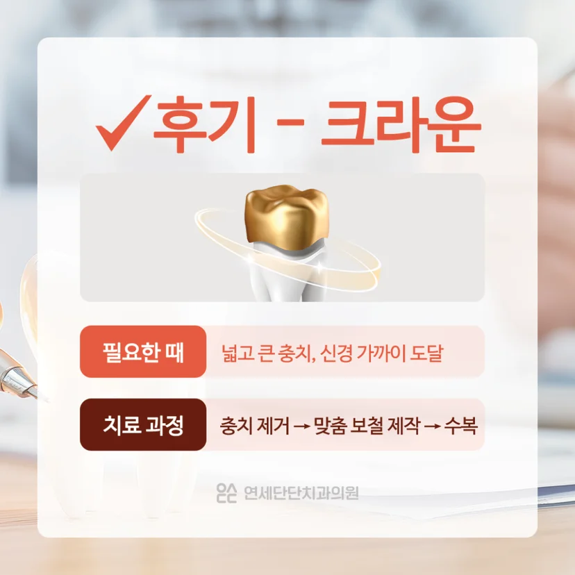 충치치료 크라운