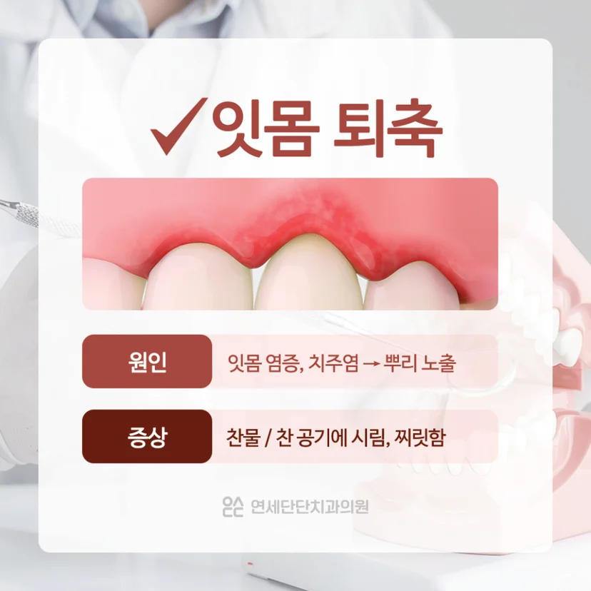 시린이 원인