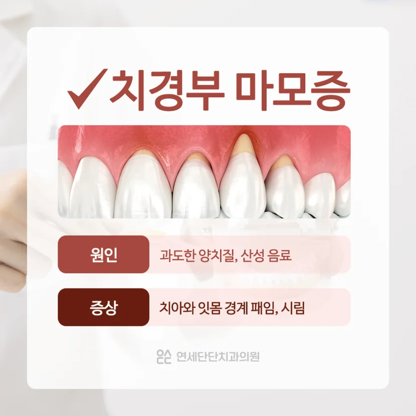 시린이 원인