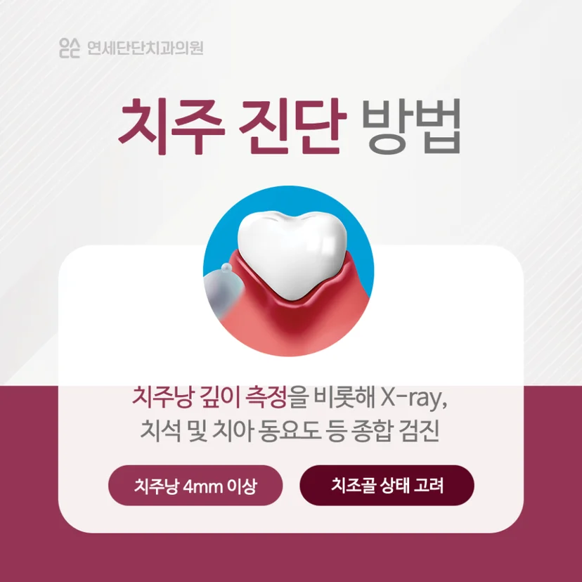 치주 진단 방법