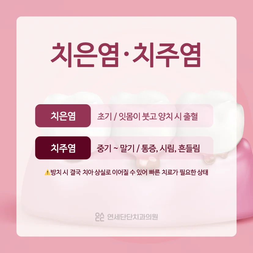 치은염 치주염 설명