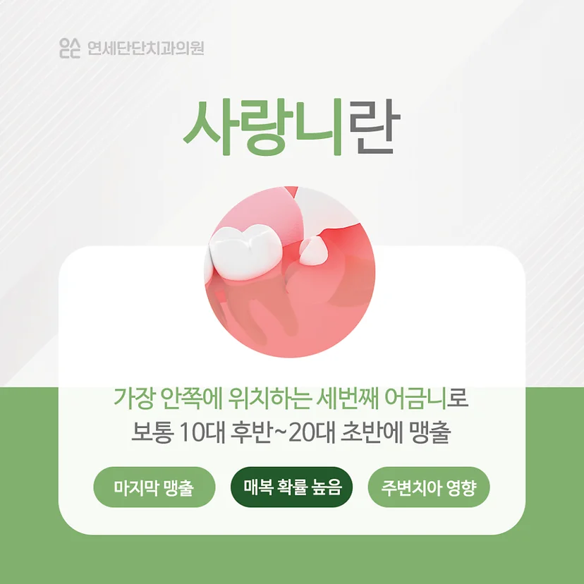사랑니 설명