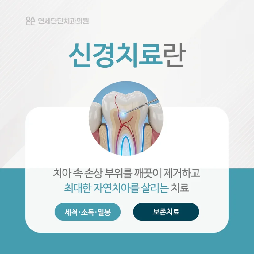 신경치료 설명