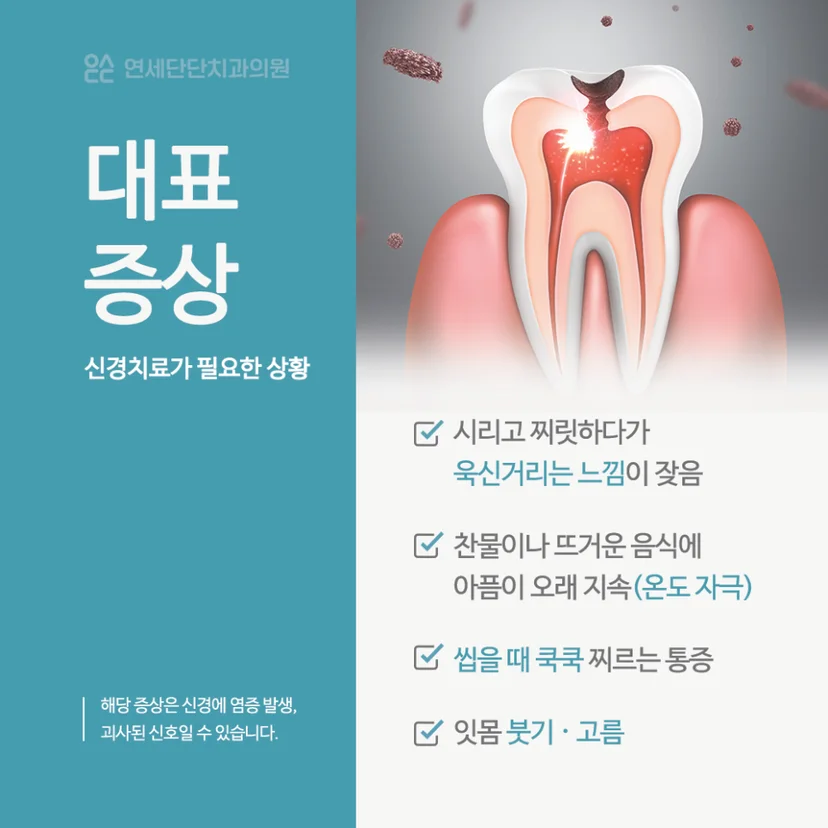 신경치료가 필요한 증상