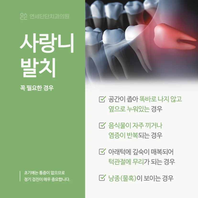 사랑니 발치 필요한 경우