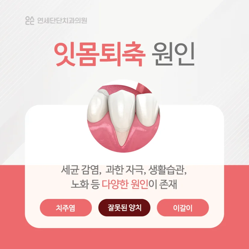 잇몸퇴축 원인
