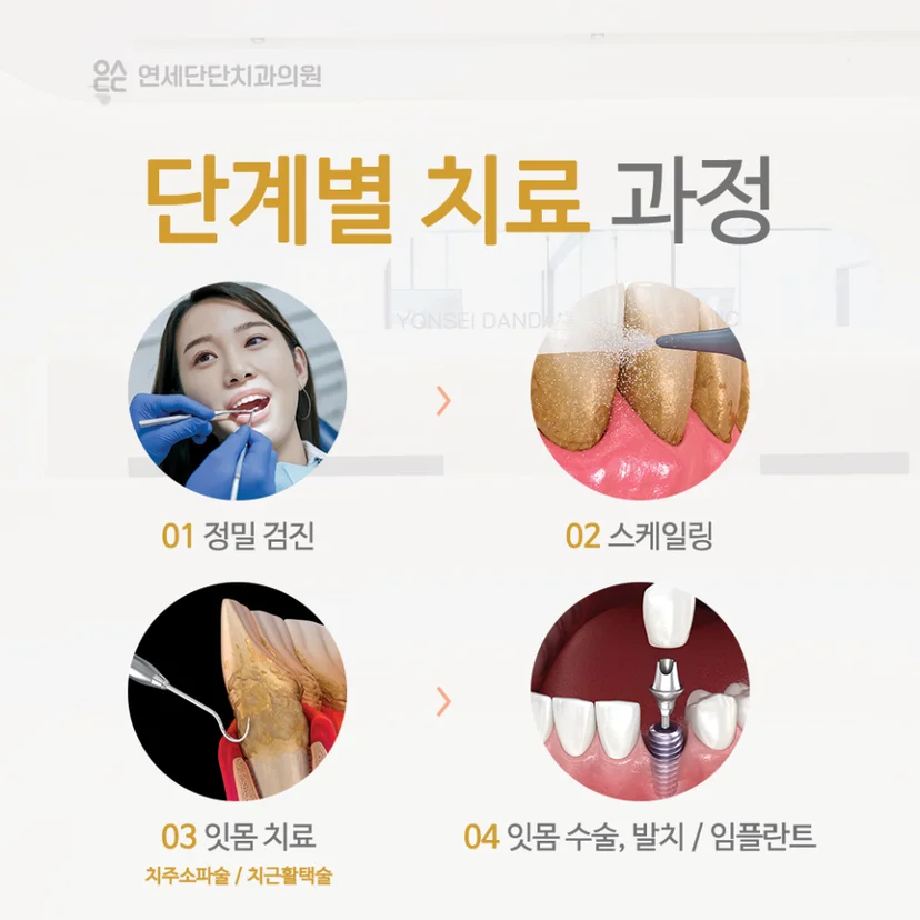 잇몸 염증 단계별 치료