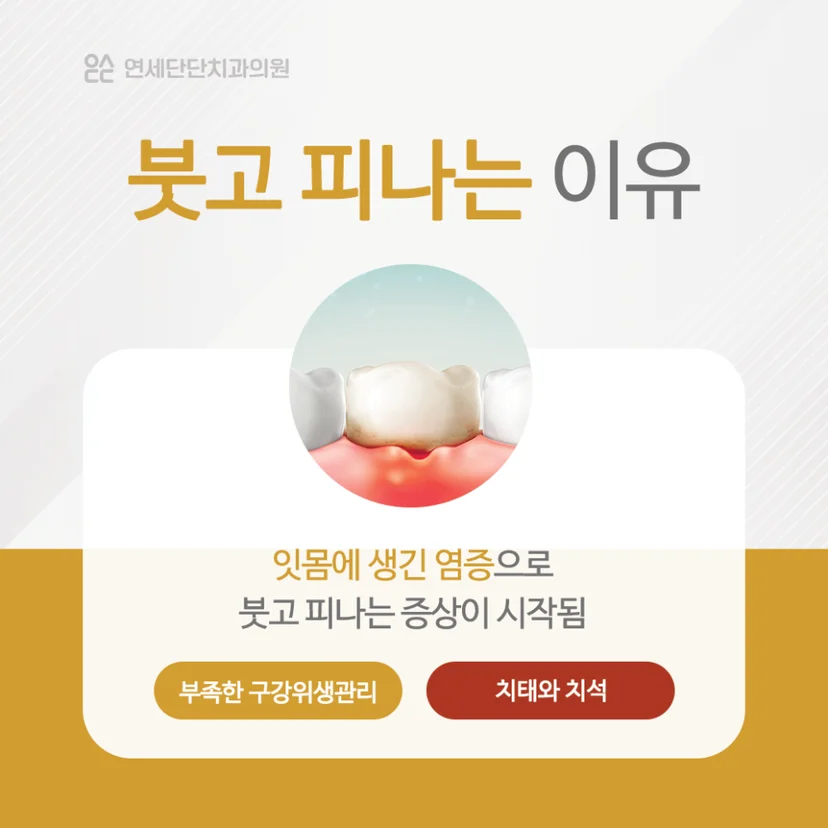 잇몸이 붓고 피나는 이유