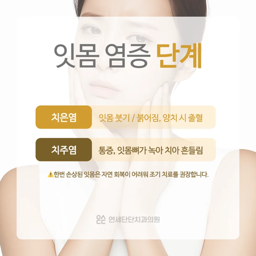 잇몸 염증 진행 단계