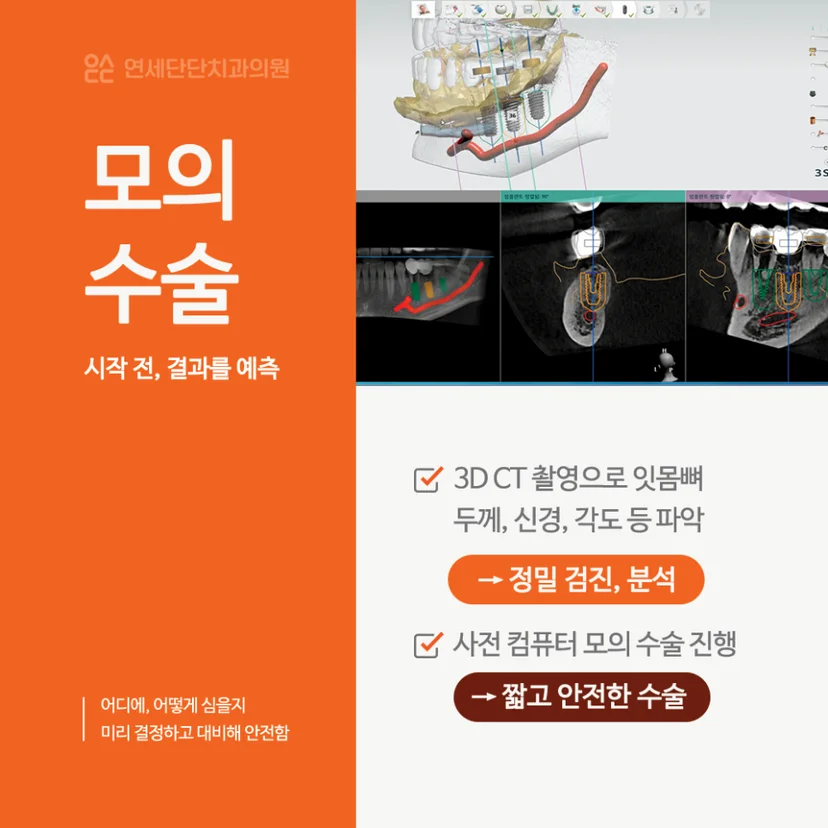 오스템 임플란트 모의 수술