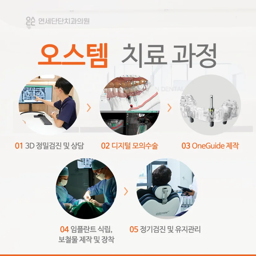 오스템 임플란트 과정
