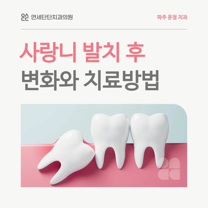 사랑니 발치 후 변화 표지