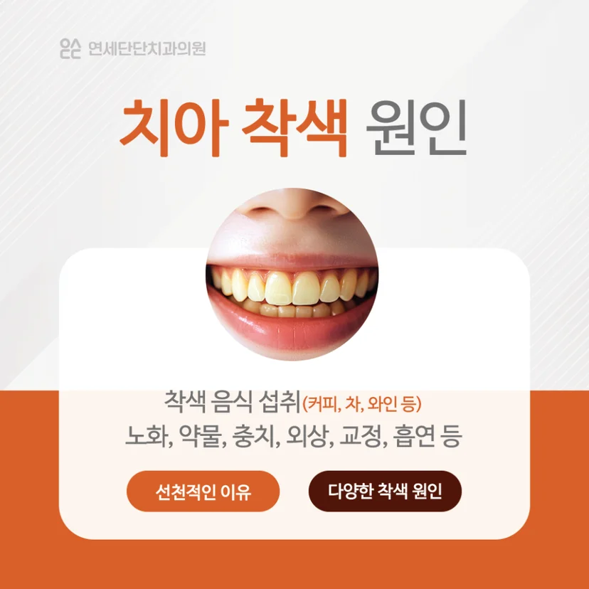 치아 미백이 필요한 대상