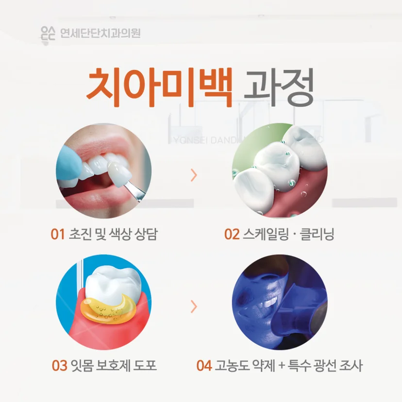 치아미백 과정