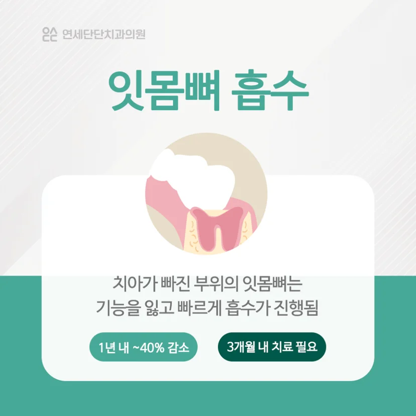 치아 상실 후 치조골 흡수