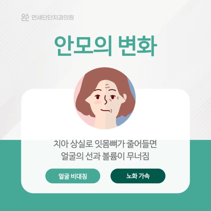 치아 상실 후 안모 변화