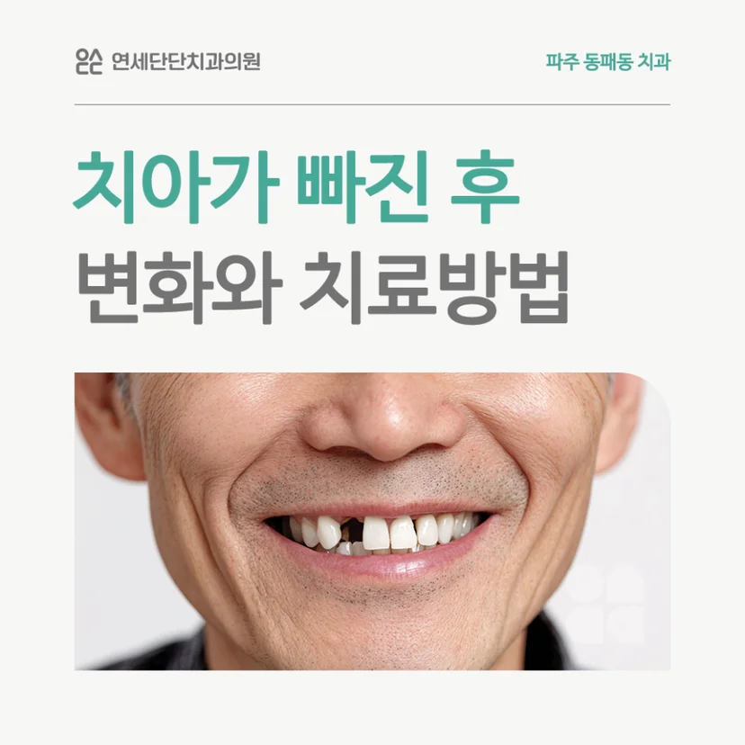 치아 상실 표지