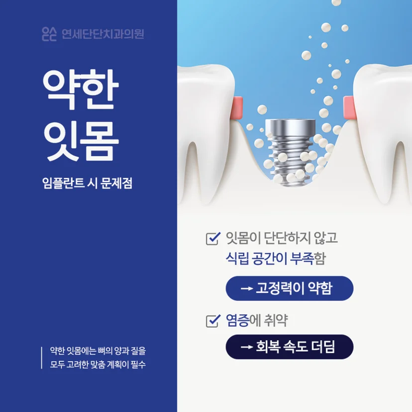 약한 잇몸 임플란트 문제점