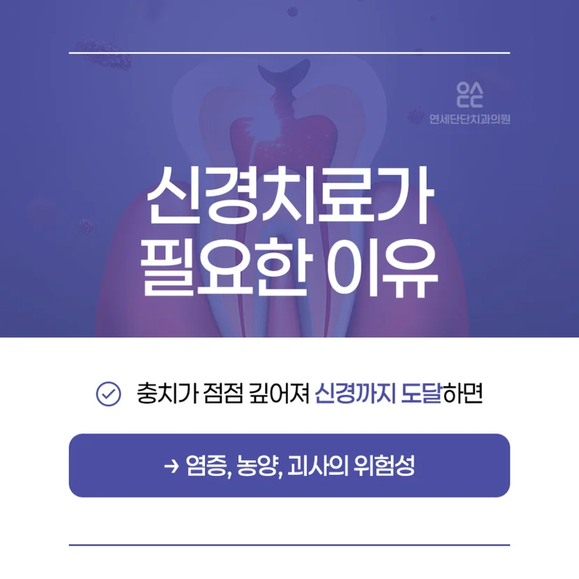 신경치료가 필요한 이유