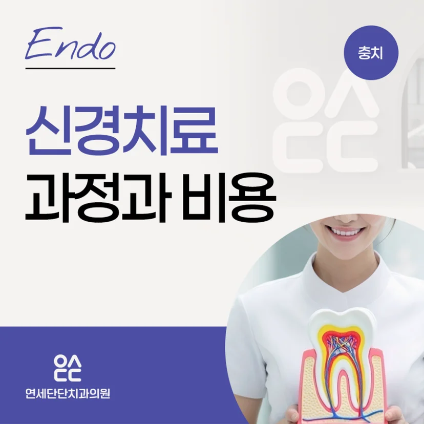신경치료 과정과 비용 표지