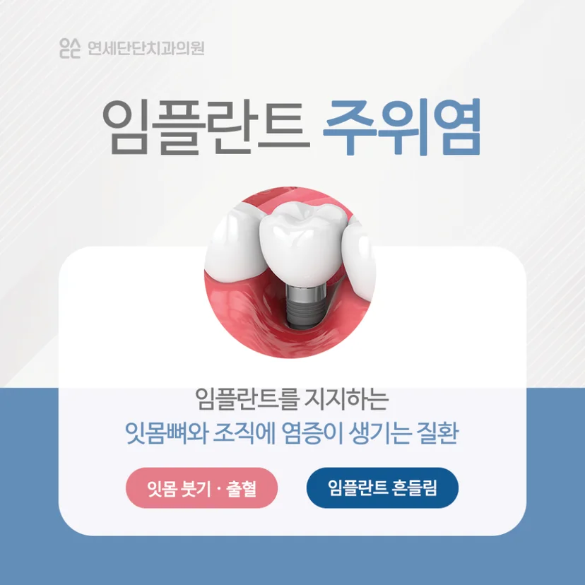 임플란트 주위염 설명