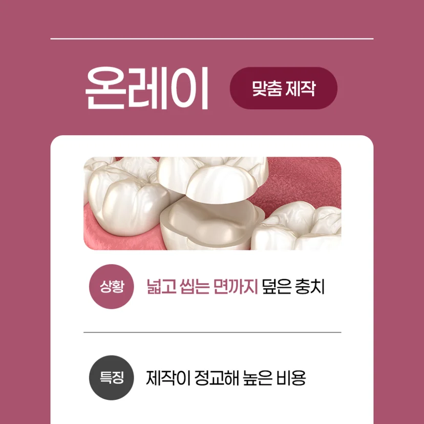 온레이 충치 치료