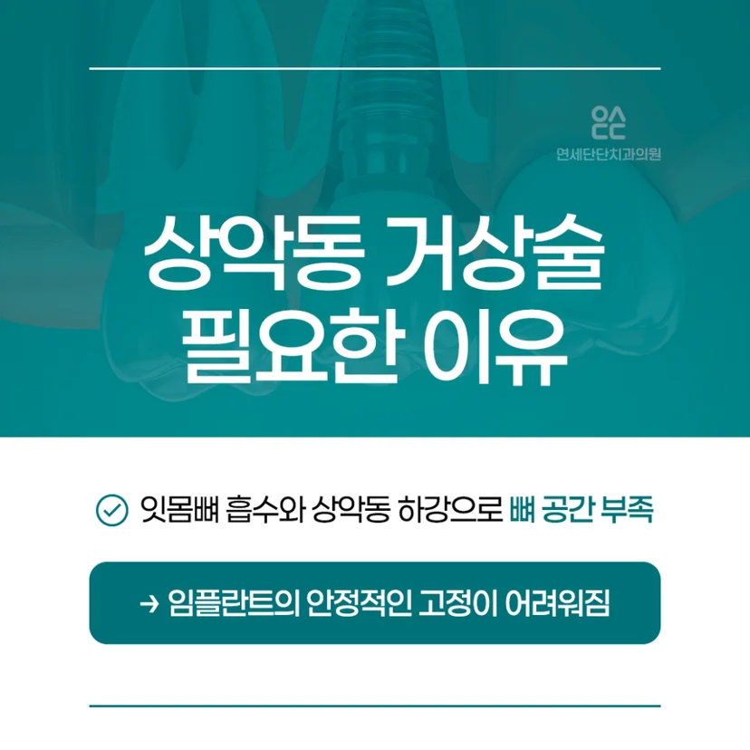 임플란트 상악동 거상술 대상