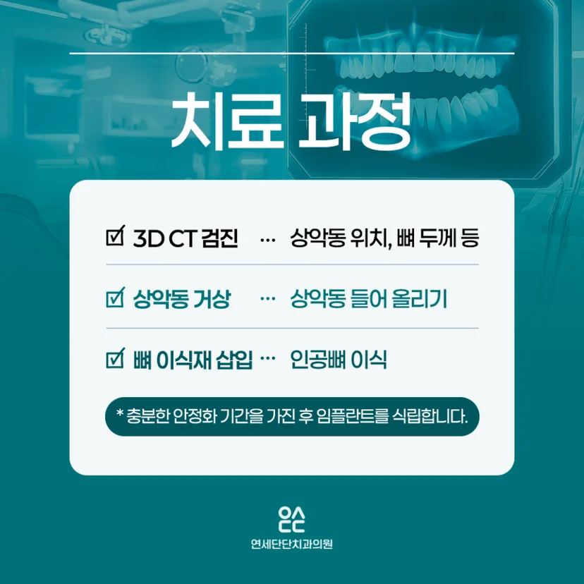 임플란트 상악동 거상술 진행 과정