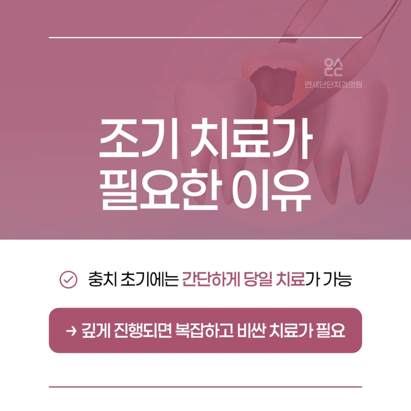 조기 충치 치료