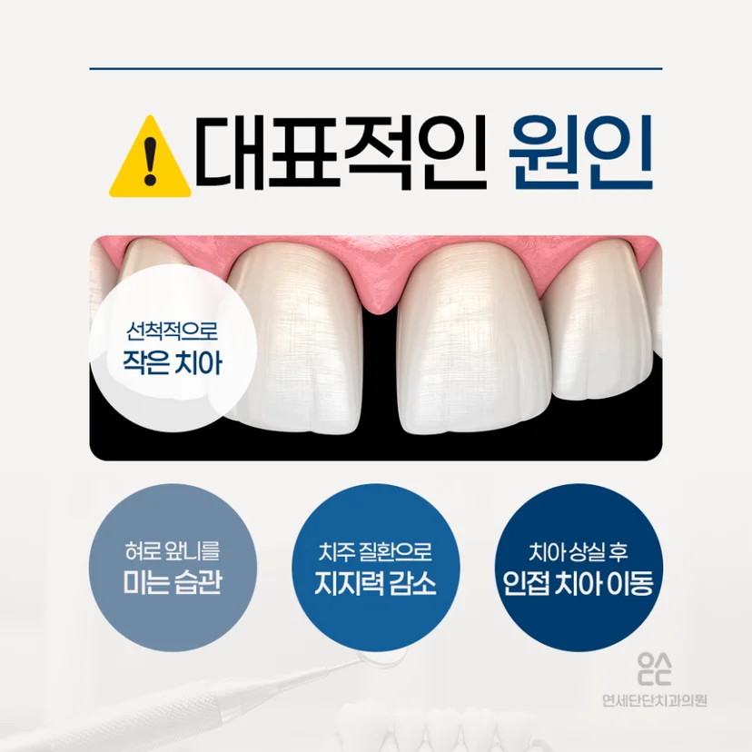 앞니 벌어짐 원인
