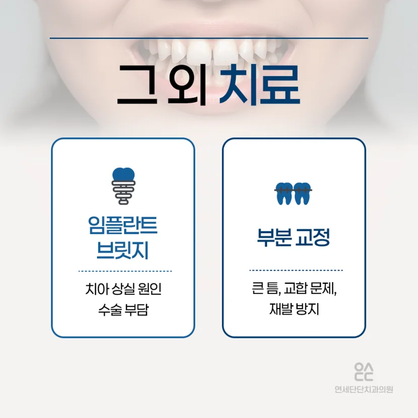 앞니 벌어짐 치료