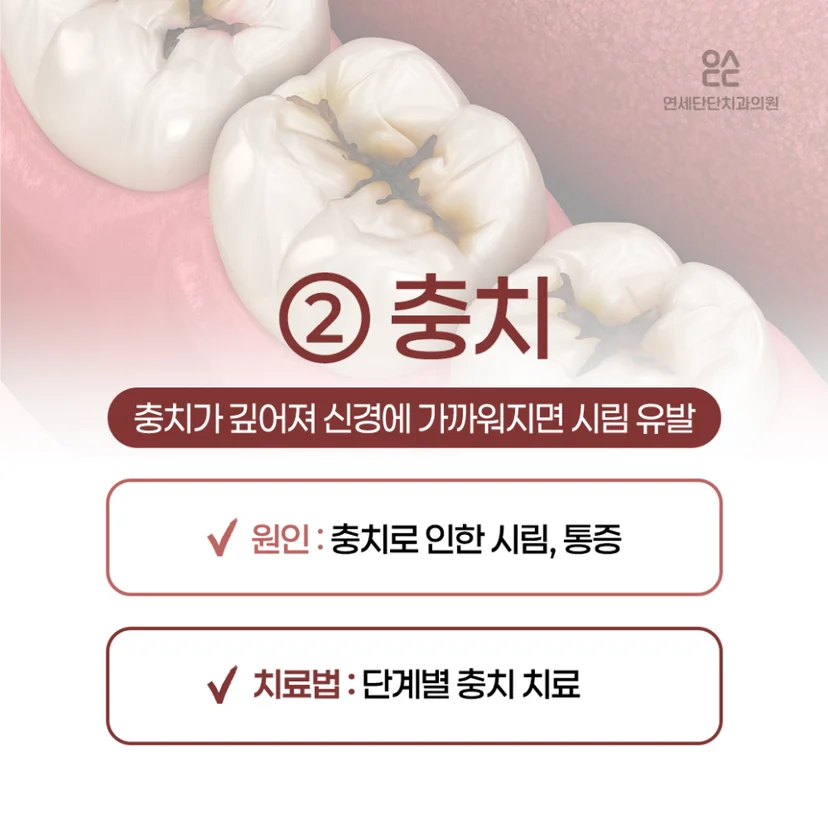 이 시림 원인, 충치