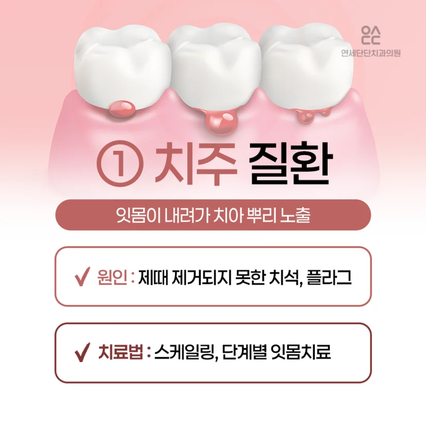 이 시림 원인, 치주질환