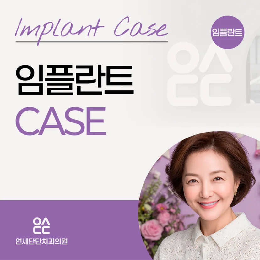 임플란트 사례 표지