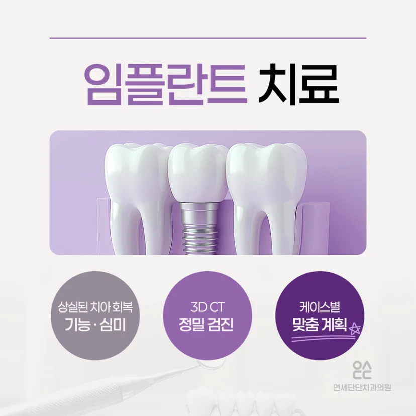 임플란트 설명