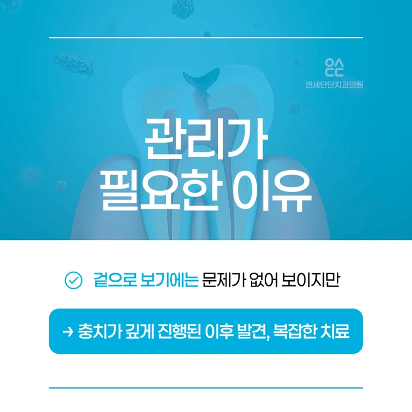 충치 관리 필요성