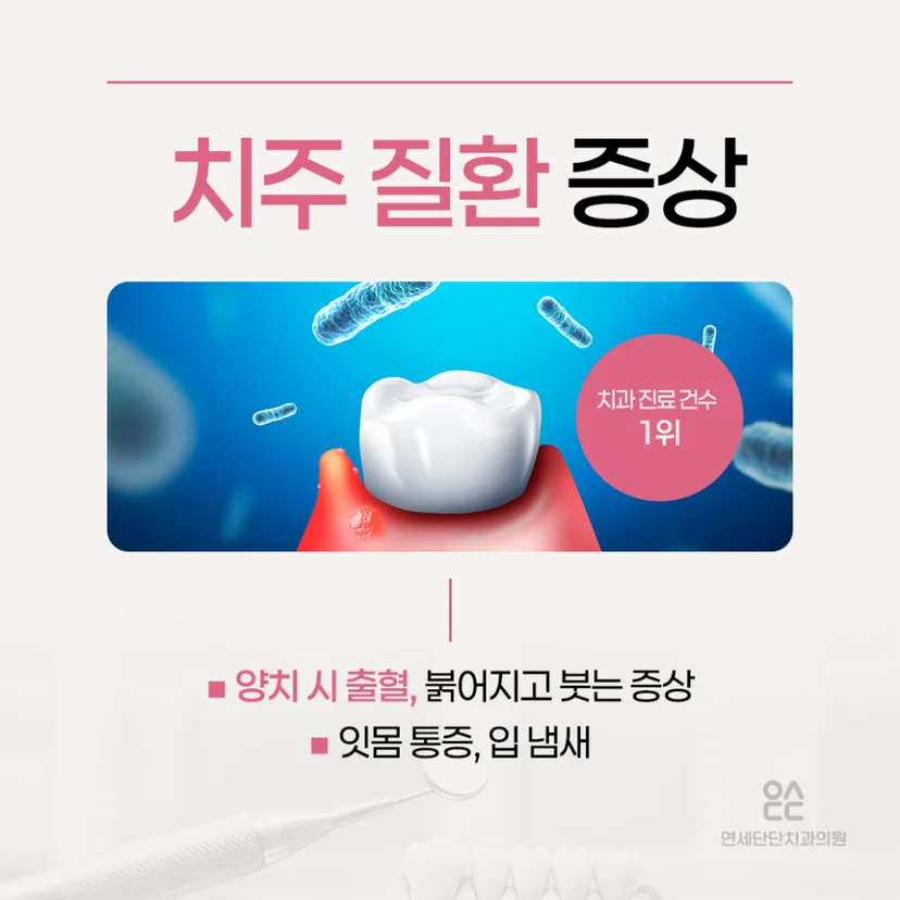 치주 질환 증상