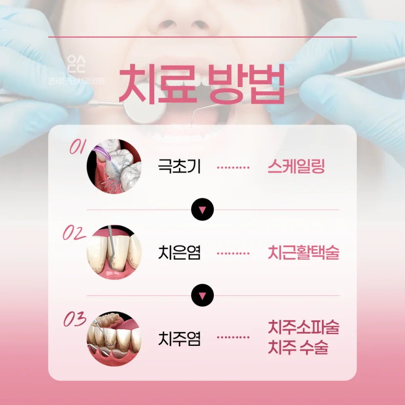 치주 질환 잇몸 치료