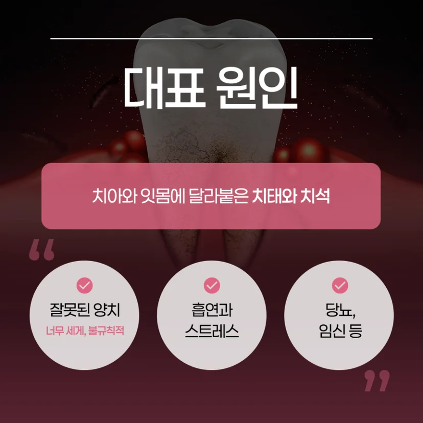 치주 질환 원인