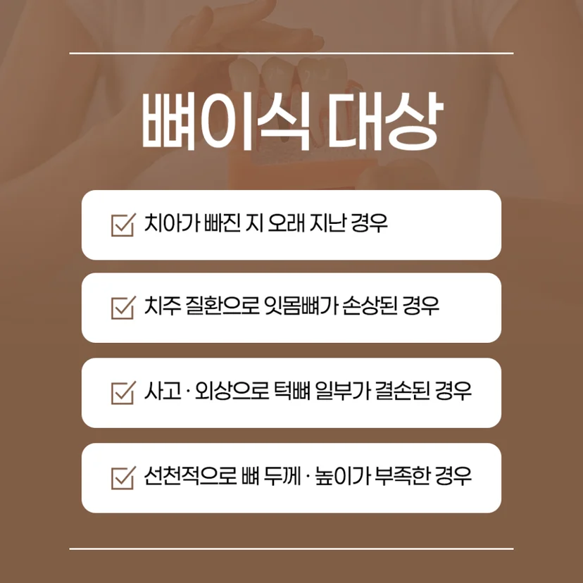 임플란트 뼈이식 대상