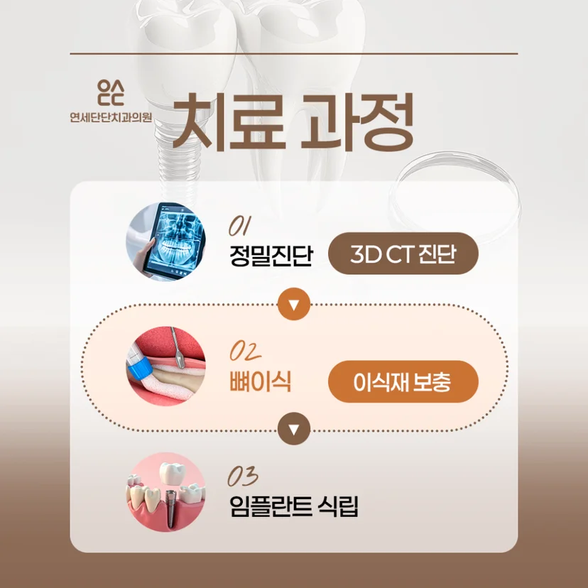 임플란트 뼈이식 과정