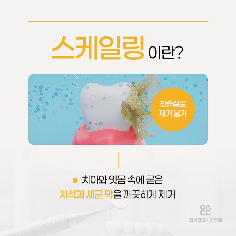 스케일링 설명