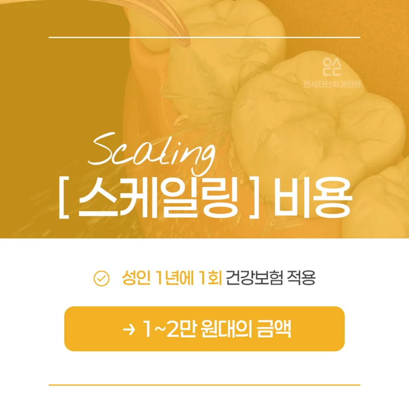 스케일링 시간 및 비용