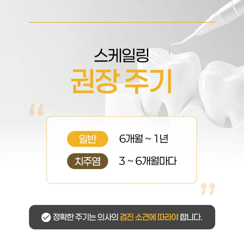 스케일링 주기