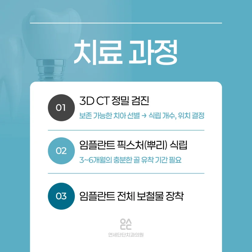 전체 임플란트 치료 과정
