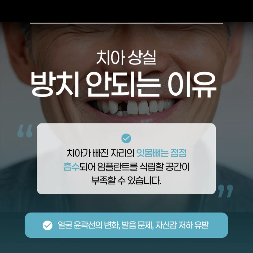 치아 상실 방치하면 안 되는 이유
