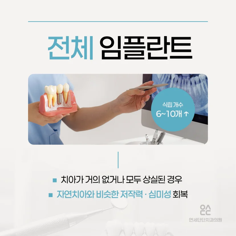 전체 임플란트 설명