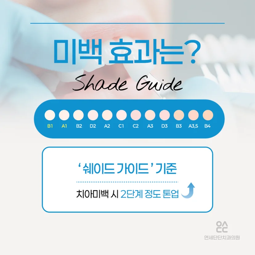 치아미백 효과