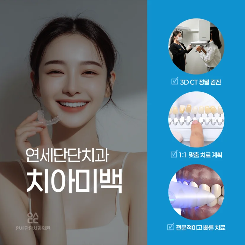 치아미백 과정
