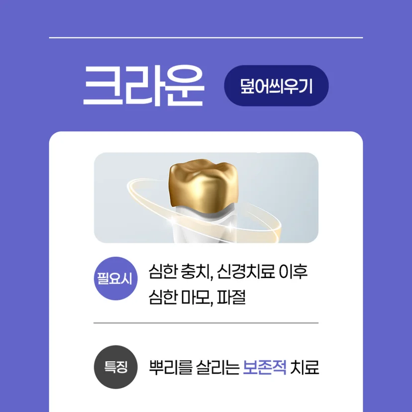 크라운 보철치료